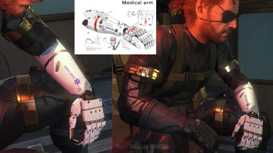 Bionic arm Medical Arm reskin WIP