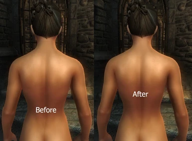 Imperial Back Before-After