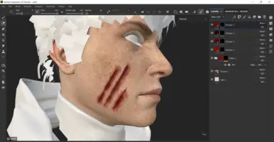 Custom wound