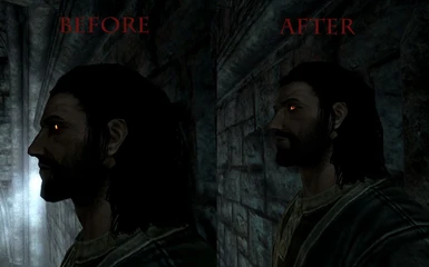 Before and After Side View