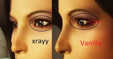 xrayys hd eye normal map