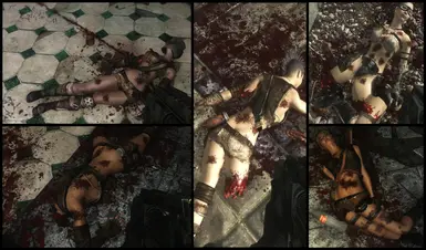 bullet wounds
