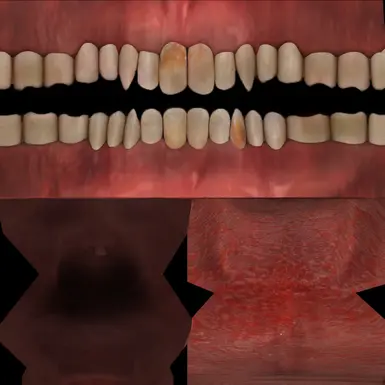 TEETH at Fallout New Vegas - mods and community