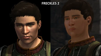 Male Hawke Freckles 2