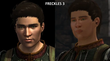 Male Hawke Freckles 3