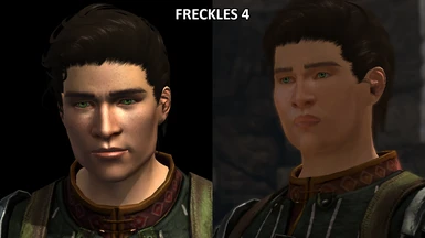 Male Hawke Freckles 4