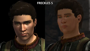 Male Hawke Freckles 5