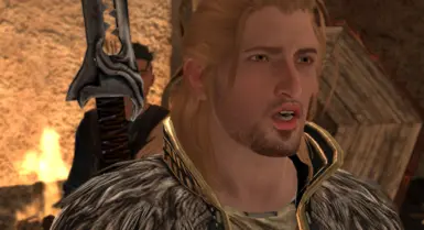 Anders - Siamese Hair