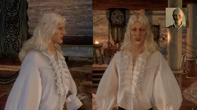 Vingalmo (Alt Appearance)
