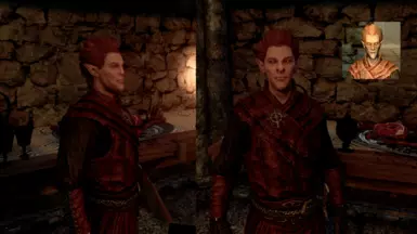 Ronthil (Alt Appearance)