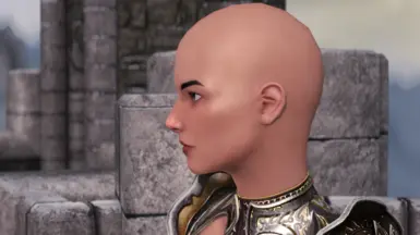 Sideview No HPH