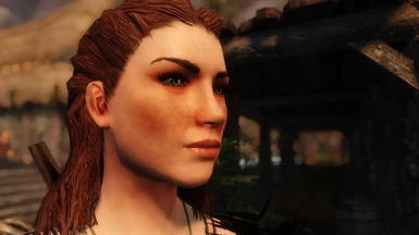 Nord w/ Freckles