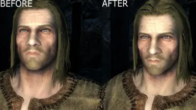 Male Complexion Redness Removal at Skyrim Special Edition Nexus - Mods ...