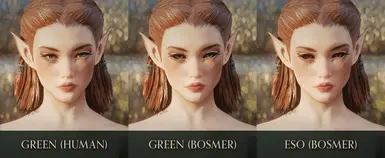 Eye Options