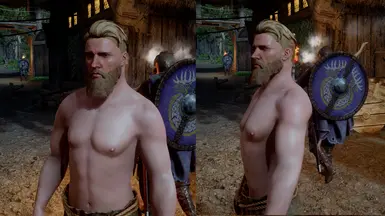 Sinding (Alt Appearance)