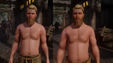 Sinding (Alt Appearance)