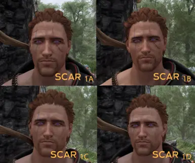 Optional Scar