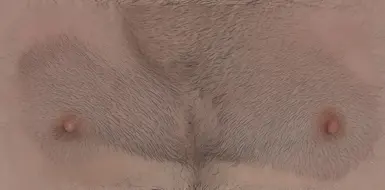 new male skin