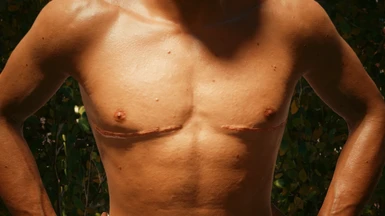 Top Surgery Scars (Scar Replacer)