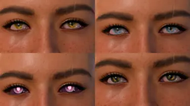 Sectoral Heterochromia Cat Eye