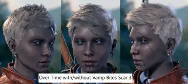 Version 2 with Vamp Bites