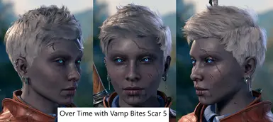 Version 2 with Vamp Bites