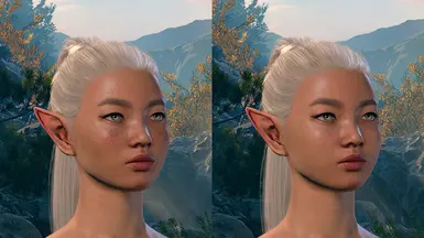 Head A with and without freckles