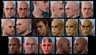 **quick overview of scars AKA my bald head collection