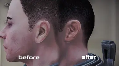 scalp / ears