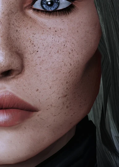 Freckled V2 Details