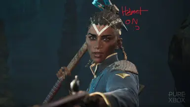 Attached Hair for Nor