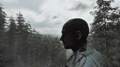 No Hair