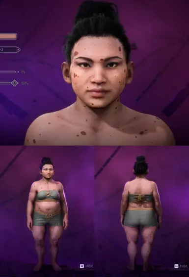 Birthmarks Full-Body (Dwarf)
