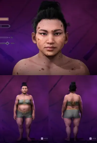 Birthmarks and Freckles Full-Body (Dwarf)