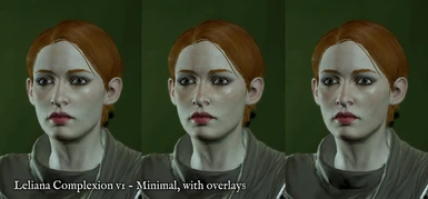 v1 - Minimal - with freckle and veiny overlays