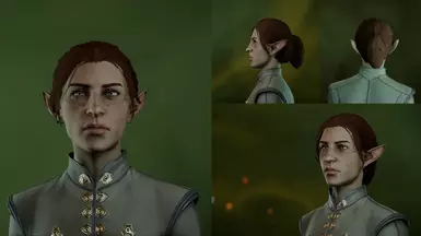 EM