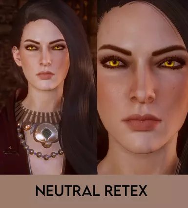 Neutral