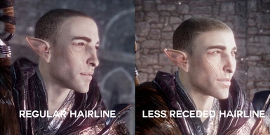 hairlines