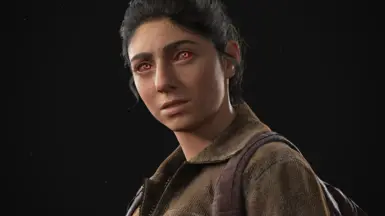 Infected Rage Eye With Infected Sclera