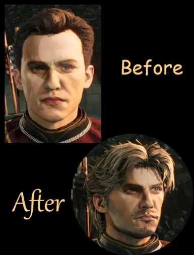 "Meton" Comparison