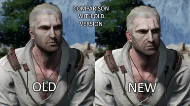 COMPARISON