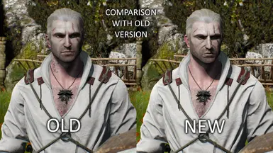 COMPARISON 