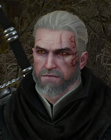 Lighter Scar with HoS