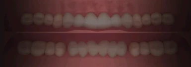 Darkend Teeth