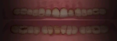 Filthy Teeth