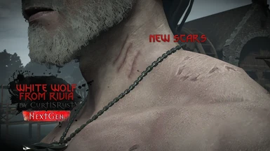 New Scars